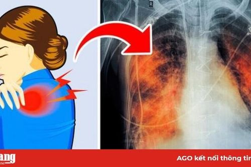 Có 5 dấu hiệu này chứng tỏ phổi của bạn đang 'kêu cứu', tuyệt đối không được chủ quan