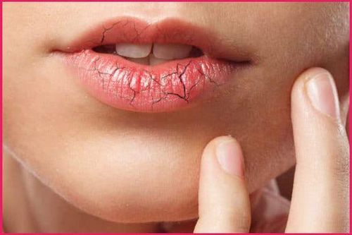Tác dụng phụ của thuốc chống trầm cảm clomipramine và cách khắc phục