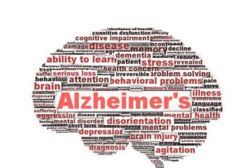 Tích lũy mảng bám Amyloid xuất hiện trước khi có triệu chứng của bệnh Alzheimer
