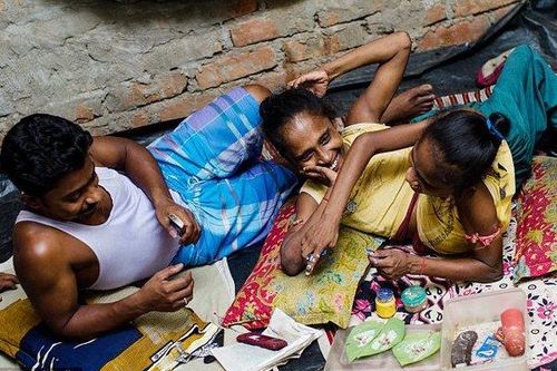 Chuyện tình cảm động của cặp chị em 'người nhện' dị dạng với anh thanh niên kém 9 tuổi đẹp trai