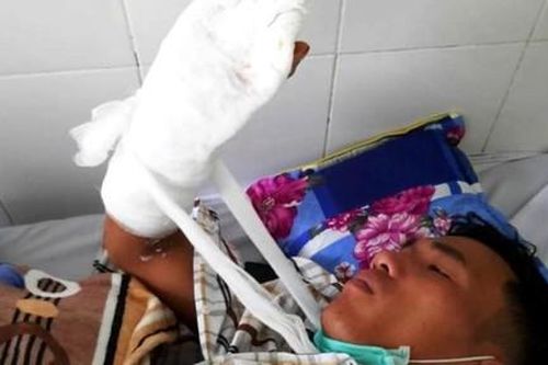 Cán bộ bảo vệ rừng bị chém: Tỉnh Kon Tum chỉ đạo khẩn trương điều tra