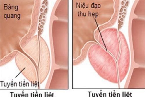 Những phương thuốc từ cỏ nhọ nồi