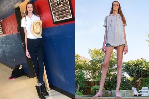Cô gái 16 tuổi cao 2,1 m, sở hữu đôi chân dài nhất thế giới
