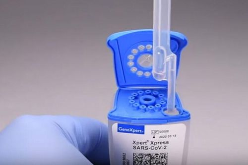 Mỹ trình làng bộ xét nghiệm COVID-19 cho kết quả nhanh trong 45 phút
