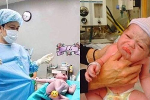 Những bé sơ sinh vừa chào đời đã có biểu cảm 'khó đỡ' khiến cả ê-kíp đỡ đẻ cũng phải bất ngờ