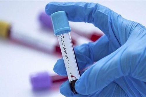 Yandex cung cấp dịch vụ xét nghiệm miễn phí virus SARS-CoV-2