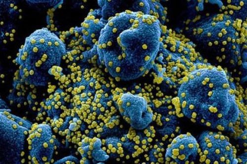 Vì sao cơn bão cytokine có thể gây tử vong ở bệnh nhân COVID-19?