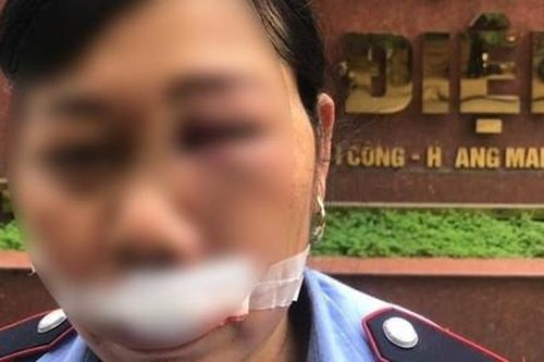 Người giao hàng đánh nữ bảo vệ vì không được lên căn hộ