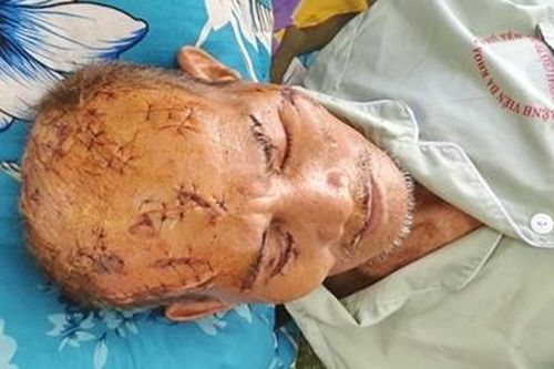 Nghi án cha bị con trai và cháu nội tấn công với 17 vết thương