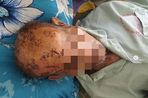 Nghi vấn ông lão 74 tuổi bị con, cháu rạch nát đầu vì tranh giành đất đai