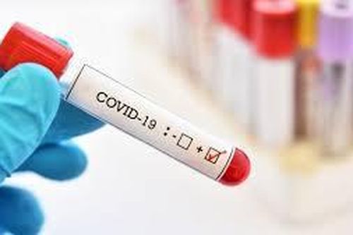 7 thói quen cần thay đổi trong mùa dịch Covid-19