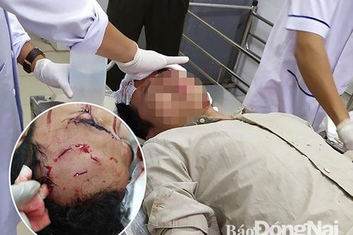 Một kiểm lâm viên Khu bảo tồn bị nhóm côn đồ hành hung gây thương tích