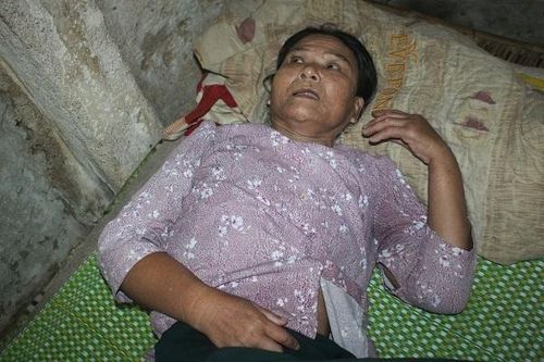Cuộc đời cô độc của người phụ nữ động kinh không chồng, không con