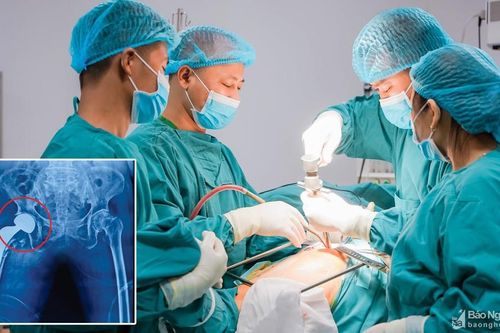 Phẫu thuật thay khớp háng thành công cho cụ bà 101 tuổi ở Nghệ An