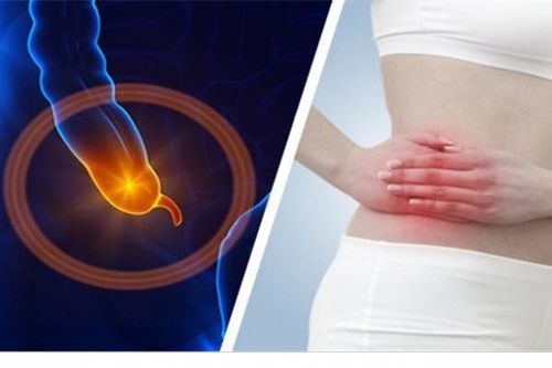 Dấu hiệu viêm ruột thừa cấp