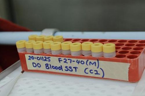 Tín hiệu tích cực từ một nghiên cứu về thuốc điều trị COVID-19