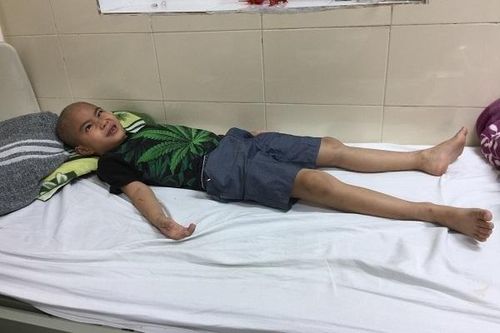 Con liên tiếp mổ não, cả nhà có nguy cơ 'ra đường'