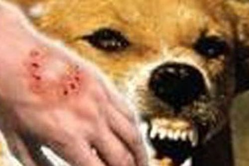 Bé trai mất mạng vì vết cắn nhẹ khi chơi đùa với chó