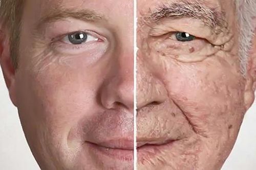 Lão hóa da và các bệnh da ở người già
