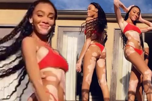 'Chân dài' Winnie Harlow diện bikini đỏ rực, catwalk tại nhà