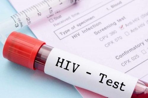 Thực hiện xét nghiệm HIV đúng quy định