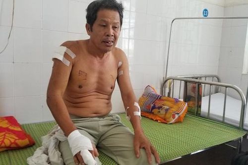 Quảng Ngãi: Cả gia đình bị chém thương tích
