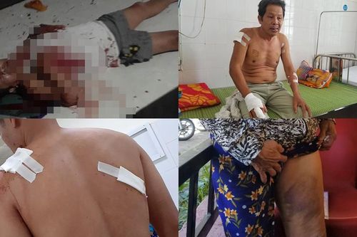 Cả gia đình tố bị hàng xóm truy sát bằng dao và mã tấu, 4 người bị thương