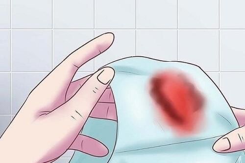 Chảy máu sau 'quan hệ' vì sao?