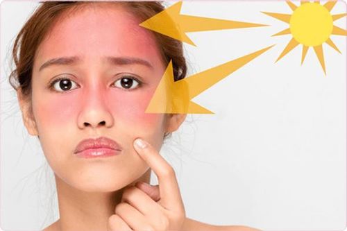Tia UV ở ngưỡng rất cao, bác sĩ chỉ cách bảo vệ cơ thể, ai cũng cần biết