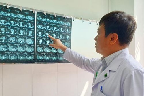Bệnh viện Hoàn Mỹ Cửu Long cắt thành công bướu giáp thòng từ cổ xuống ngực
