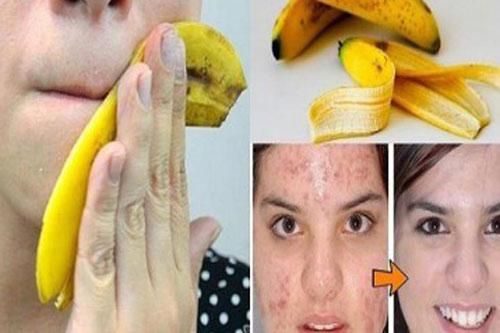 Nếu như biết được công dụng làm đẹp thần kỳ của vỏ chuối chắc chắn bạn sẽ không bỏ nó đi