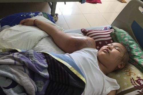 Bé gái chỉ mong được gặp ông tiên để chữa khỏi khối u khổng lồ