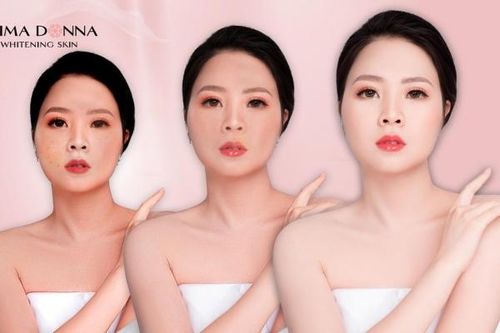 Làm trắng da, chống lão hóa an toàn, hiệu quả bằng viên uống trắng da