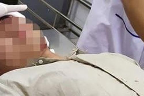 Khởi tố nhóm thanh niên chém nhân viên kiểm lâm, cướp lại xe máy