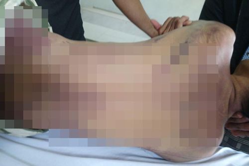 Khởi tố vụ án bị án chết trong nhà tạm giữ
