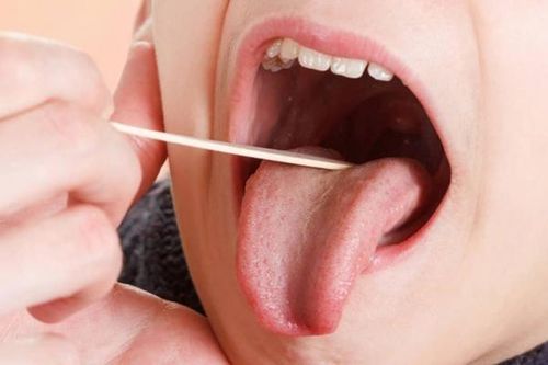 Viêm amidan gây biến chứng gì?