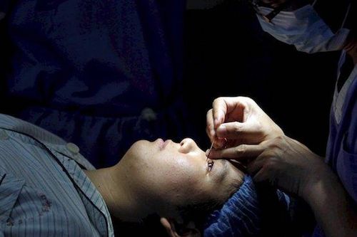 Nhu cầu phẫu thuật thẩm mỹ tại Nhật Bản gia tăng bất chấp dịch COVID-19