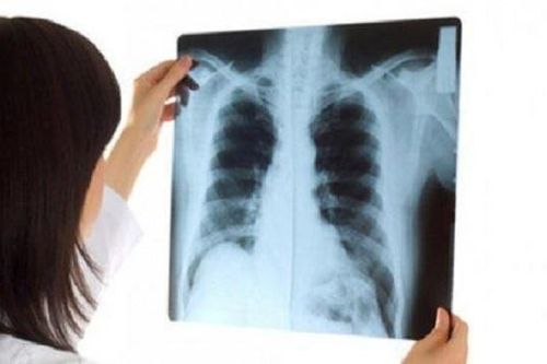 Thói quen không ngờ 'giết chết' phổi, nhiều người Việt làm hàng ngày