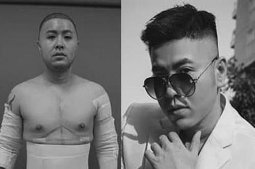Hình ảnh hiện tại của Akira Phan sau khi 'đập mặt', hút mỡ để 'níu kéo hào quang'