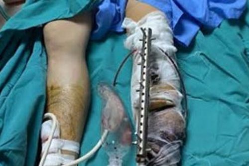 Điều tra vụ xông vào nhà chém người trọng thương