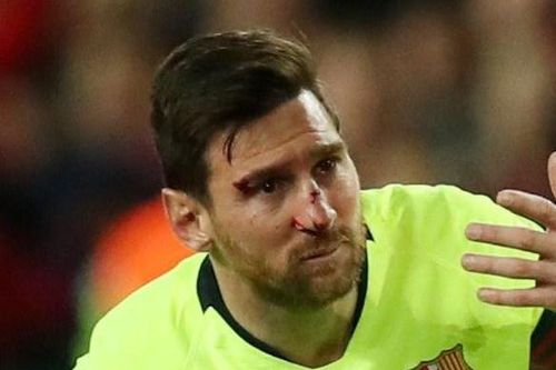 Melo tiết lộ giai thoại huých trỏ khiến Messi chảy máu mũi