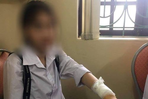 Nam thanh niên dùng dao rạch tay nữ sinh để trêu đùa