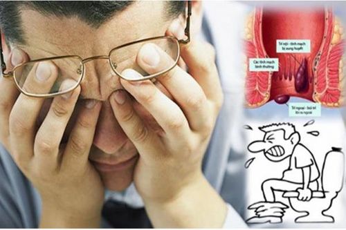 Giải pháp co búi trĩ nhanh chóng