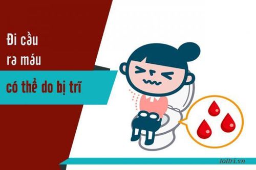 Giảm nhanh chảy máu trong bệnh trĩ