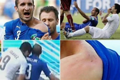Chiellini nói điều bất ngờ về vụ bị Suarez cắn