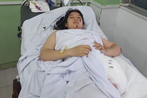 Nữ sinh 16 tuổi mất chân trái vì tai nạn trên đường đi học về