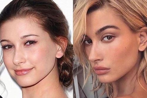Vợ Justin Bieber phủ nhận phẫu thuật thẩm mỹ