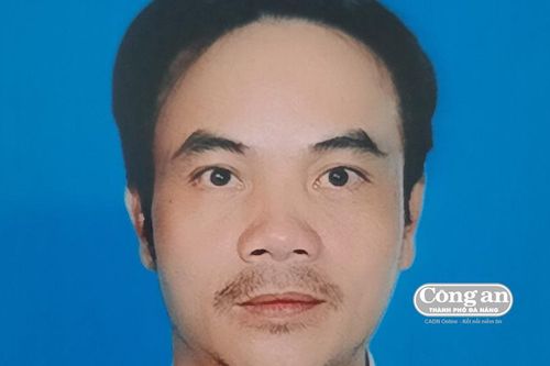 Choảng anh họ vỡ sọ