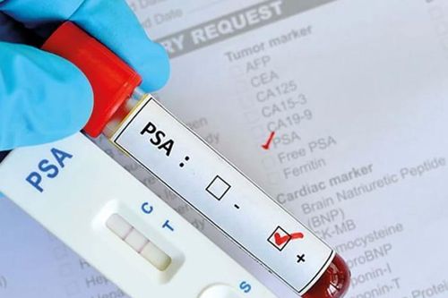 Khi nào cần xét nghiệm máu tìm ung thư?