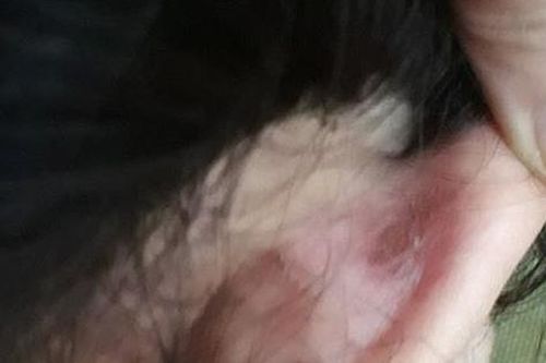 Xác minh chuyện bé gái lớp 2 ở Hà Nội nghi bị giáo viên đánh vì làm sai bài toán